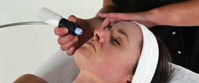 Microdermabrasion